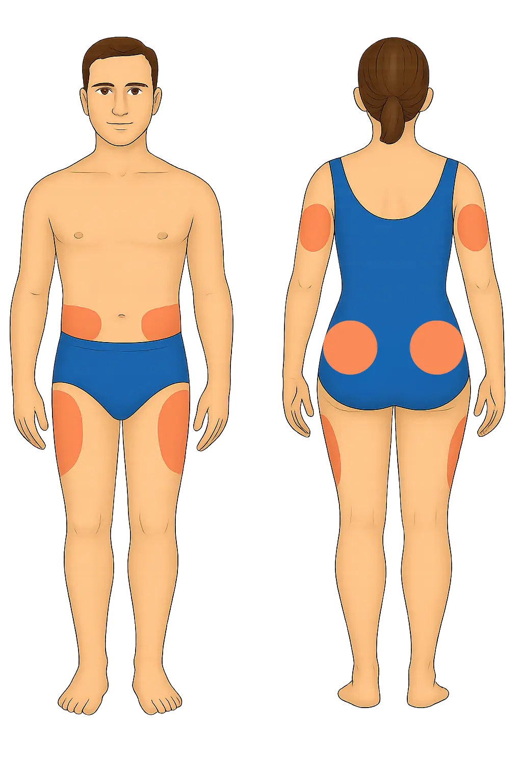 Insulin injection site diagram on a human body (male and female)