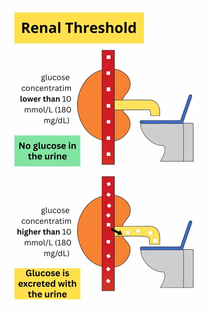 Diagram showing how glucose is excreted in urine when blood glucose exceeds the renal threshold (10 mmol/L or 180 mg/dL).