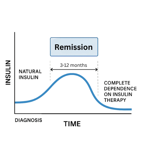 Graph showing the honeymoon phase (remission) in type 1 diabetes, with natural insulin production temporarily increasing before complete dependence on insulin therapy.