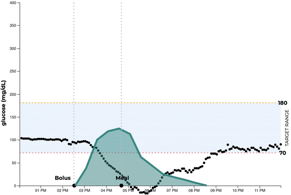 llustrative graph showing how pre-bolusing insulin before meals aligns insulin action with the post-meal glucose rise to help reduce blood sugar spikes.