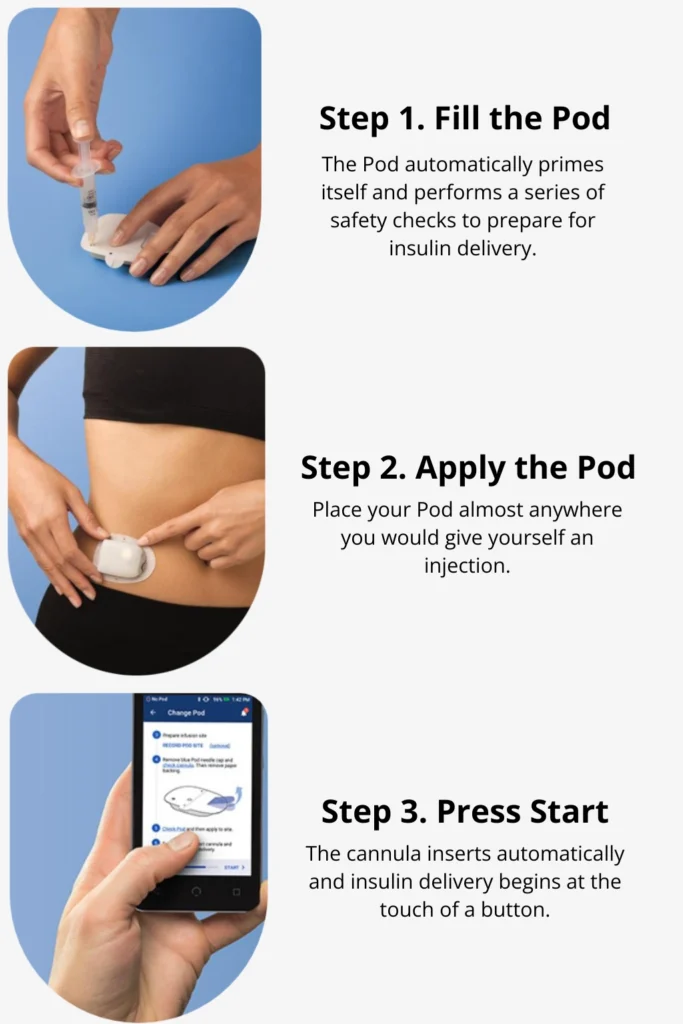 tep-by-step guide to applying and starting an insulin pod pump.